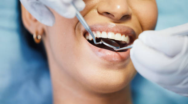 Best Chipped Tooth Repair Near Me  in Rotan, TX